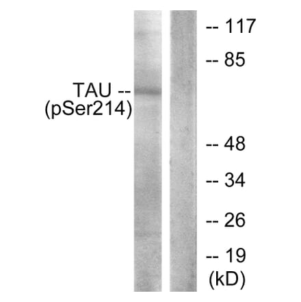 Western Blot - Anti-Tau (phospho Ser214) Antibody (A7237) - Antibodies.com