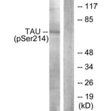 Western Blot - Anti-Tau (phospho Ser214) Antibody (A7237) - Antibodies.com