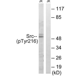 Western Blot - Anti-Src (phospho Tyr216) Antibody (A8237) - Antibodies.com