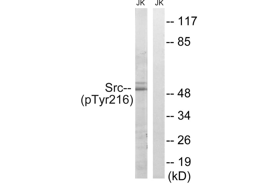 Western Blot - Anti-Src (phospho Tyr216) Antibody (A8237) - Antibodies.com