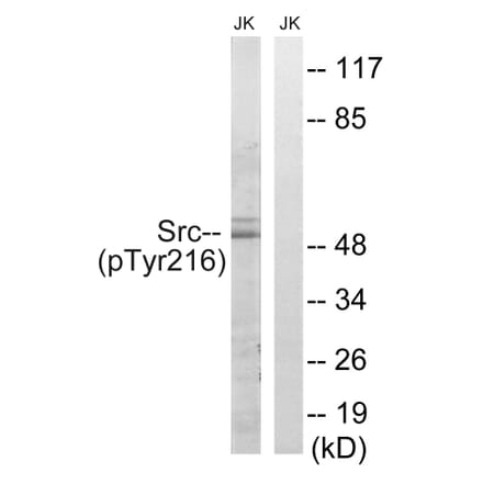 Western Blot - Anti-Src (phospho Tyr216) Antibody (A8237) - Antibodies.com