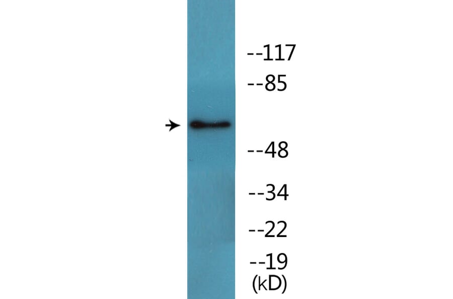 Western Blot - Anti-Src (phospho Tyr216) Antibody (P12-1180) - Antibodies.com