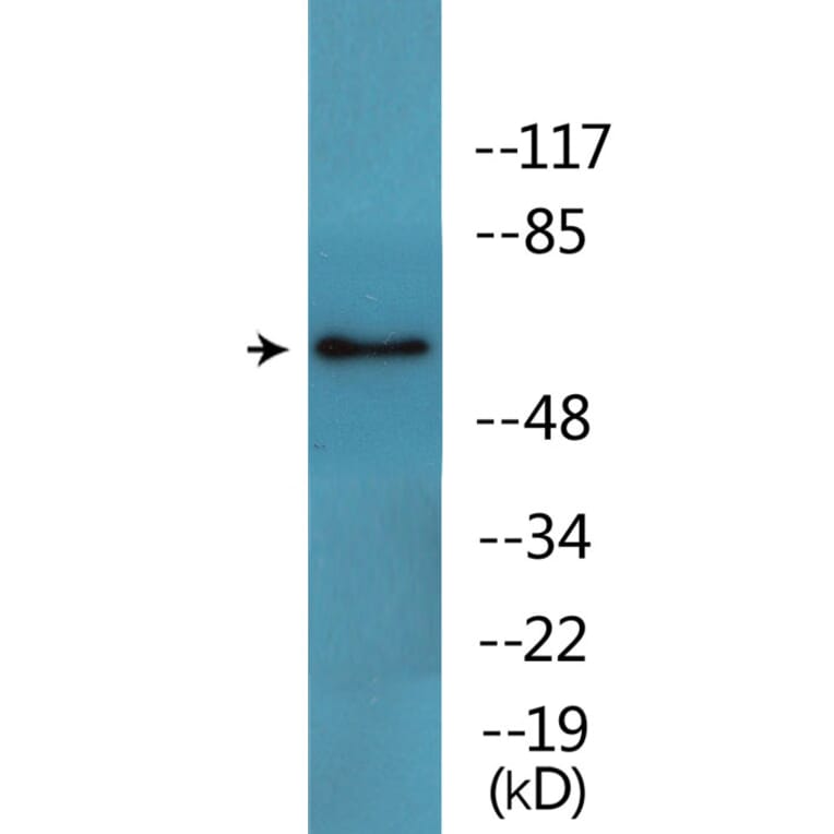 Western Blot - Anti-Src (phospho Tyr216) Antibody (P12-1180) - Antibodies.com