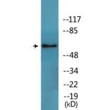 Western Blot - Anti-Src (phospho Tyr216) Antibody (P12-1180) - Antibodies.com