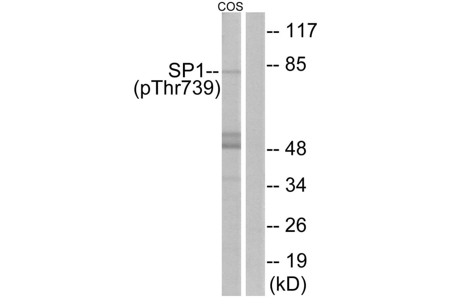 Western Blot - Anti-SP1 (phospho Thr739) Antibody (A7218) - Antibodies.com