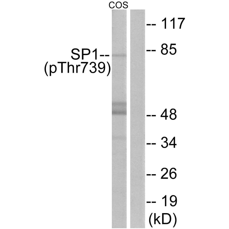 Western Blot - Anti-SP1 (phospho Thr739) Antibody (A7218) - Antibodies.com