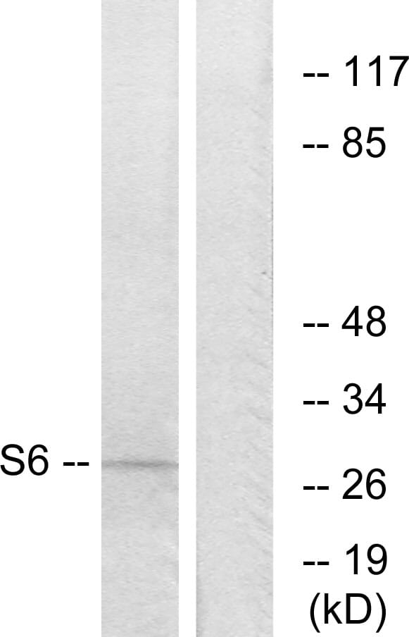 Western blot analysis of lysates from 293 cells, treated with serum 10% 15' using Anti-S6 Ribosomal Protein Antibody. The right hand lane represents a negative control, where the antibody is blocked by the immunising peptide.