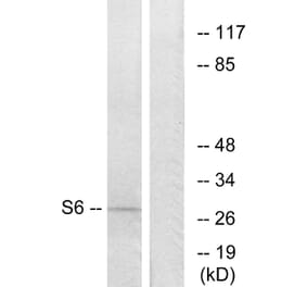 Western Blot - Anti-S6 Ribosomal Protein Antibody (B7214) - Antibodies.com