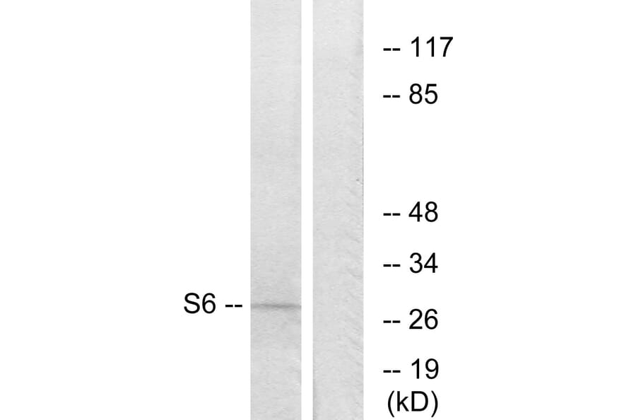 Western Blot - Anti-S6 Ribosomal Protein Antibody (B7214) - Antibodies.com