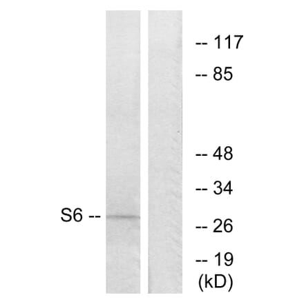 Western Blot - Anti-S6 Ribosomal Protein Antibody (B7214) - Antibodies.com