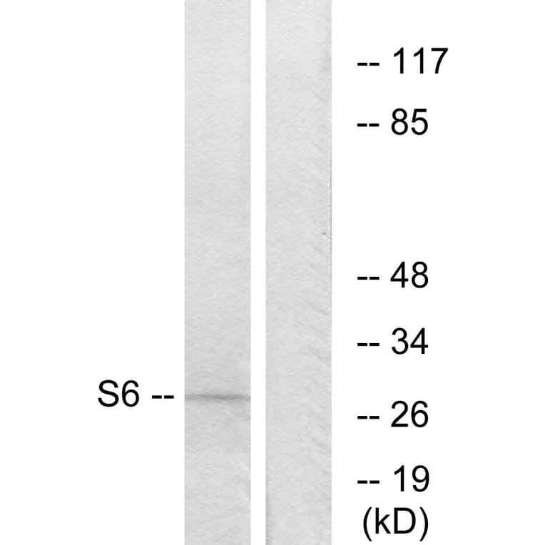 Western Blot - Anti-S6 Ribosomal Protein Antibody (B7214) - Antibodies.com