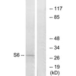 Western Blot - Anti-S6 Ribosomal Protein Antibody (B7214) - Antibodies.com