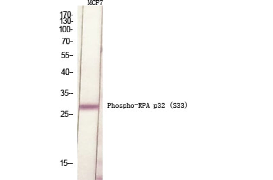 Western Blot - Anti-RFA2 (phospho Ser33) Antibody (A8411) - Antibodies.com