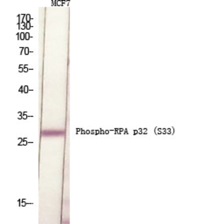 Western Blot - Anti-RFA2 (phospho Ser33) Antibody (A8411) - Antibodies.com