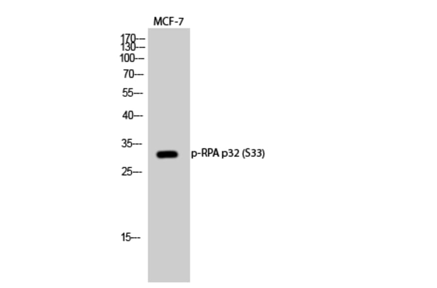 Western Blot - Anti-RFA2 (phospho Ser33) Antibody (A8411) - Antibodies.com