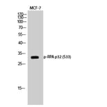 Western Blot - Anti-RFA2 (phospho Ser33) Antibody (A8411) - Antibodies.com