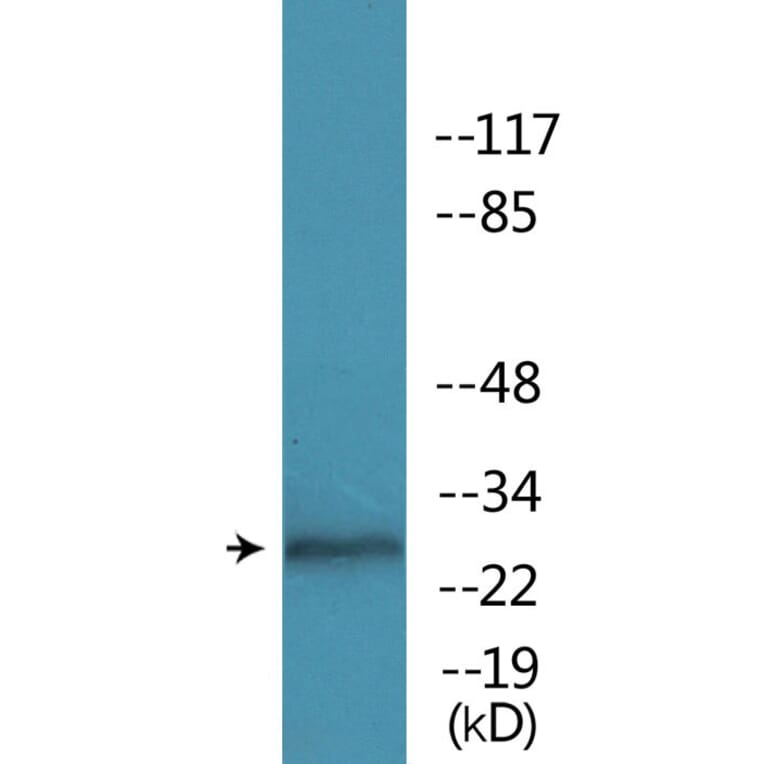 Western Blot - Anti-RFA2 (phospho Ser33) Antibody (P12-1172) - Antibodies.com
