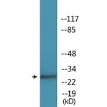 Western Blot - Anti-RFA2 (phospho Ser33) Antibody (P12-1172) - Antibodies.com