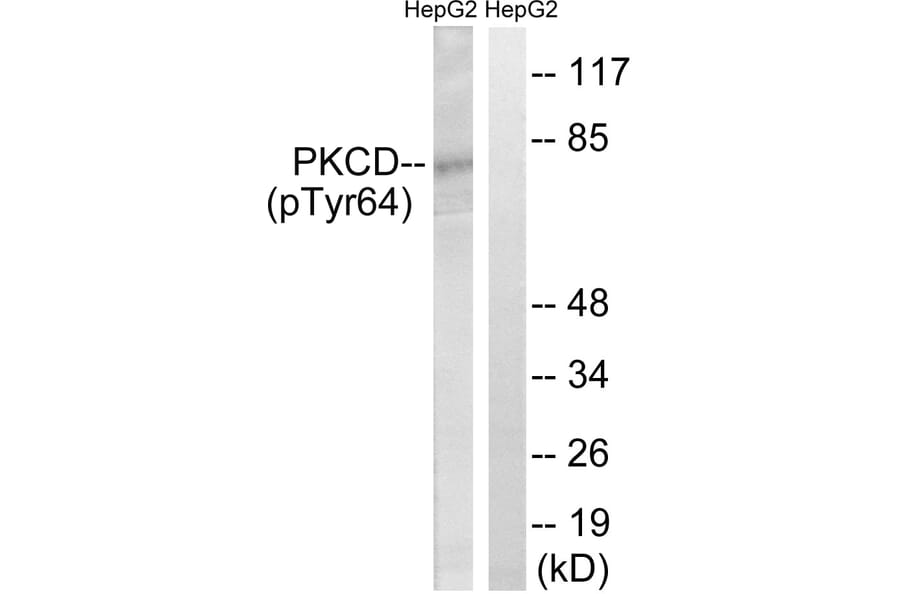 Western Blot - Anti-PKCD (phospho Tyr64) Antibody (A8171) - Antibodies.com