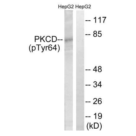 Western Blot - Anti-PKCD (phospho Tyr64) Antibody (A8171) - Antibodies.com