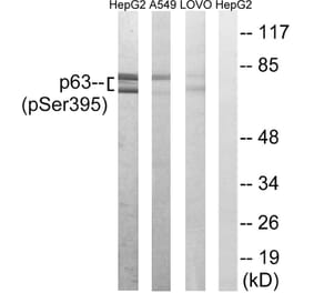Western Blot - Anti-p63 (phospho Ser395) Antibody (A8468) - Antibodies.com