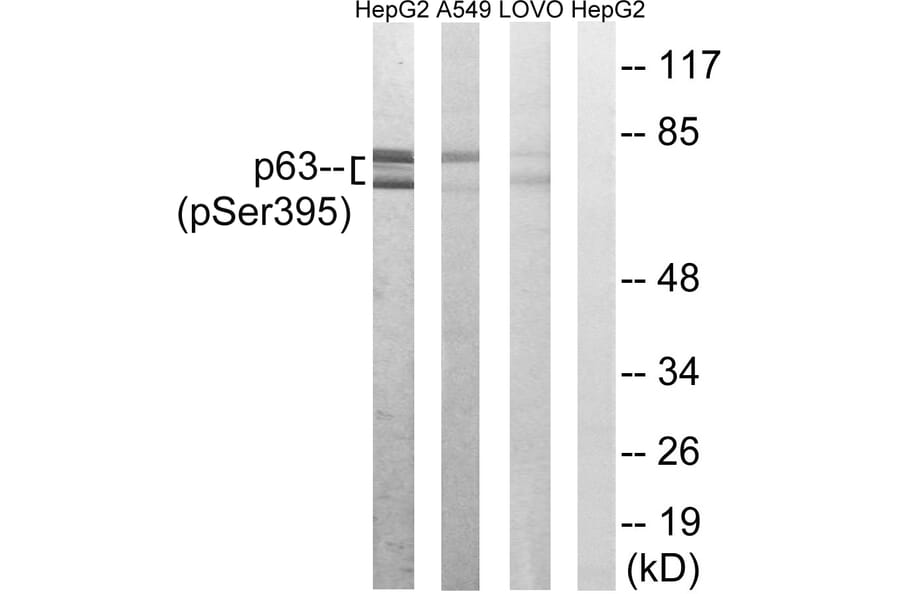 Western Blot - Anti-p63 (phospho Ser395) Antibody (A8468) - Antibodies.com