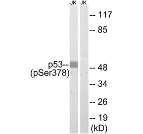 Western Blot - Anti-p53 (phospho Ser378) Antibody (A8054) - Antibodies.com