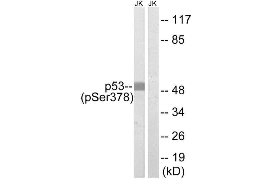 Western Blot - Anti-p53 (phospho Ser378) Antibody (A8054) - Antibodies.com