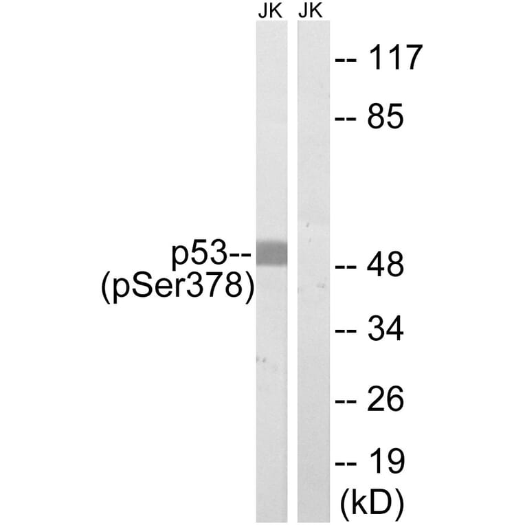 Western Blot - Anti-p53 (phospho Ser378) Antibody (A8054) - Antibodies.com