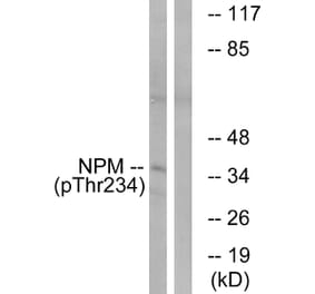 Western Blot - Anti-NPM (phospho Thr234) Antibody (A1166) - Antibodies.com