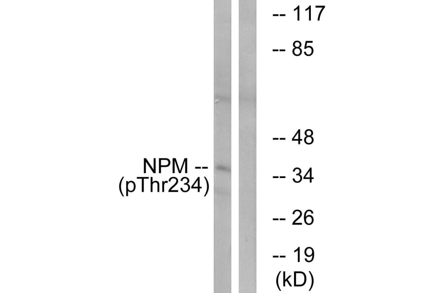 Western Blot - Anti-NPM (phospho Thr234) Antibody (A1166) - Antibodies.com