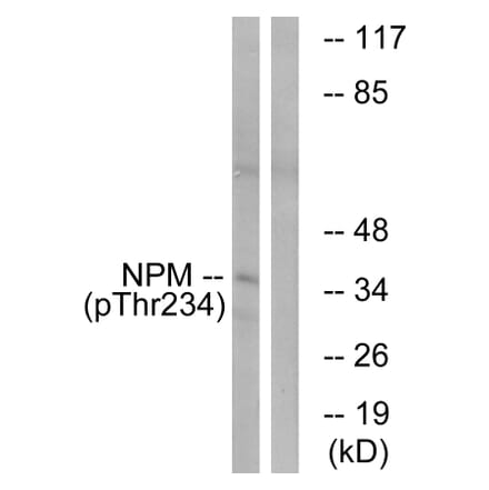 Western Blot - Anti-NPM (phospho Thr234) Antibody (A1166) - Antibodies.com