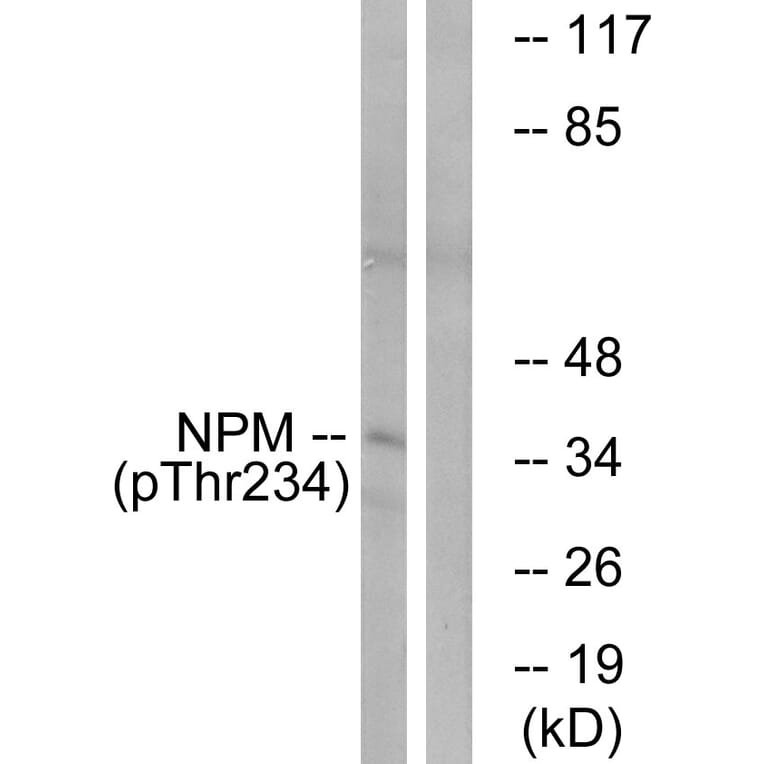 Western Blot - Anti-NPM (phospho Thr234) Antibody (A1166) - Antibodies.com