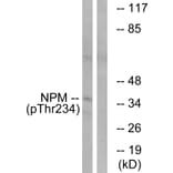 Western Blot - Anti-NPM (phospho Thr234) Antibody (A1166) - Antibodies.com