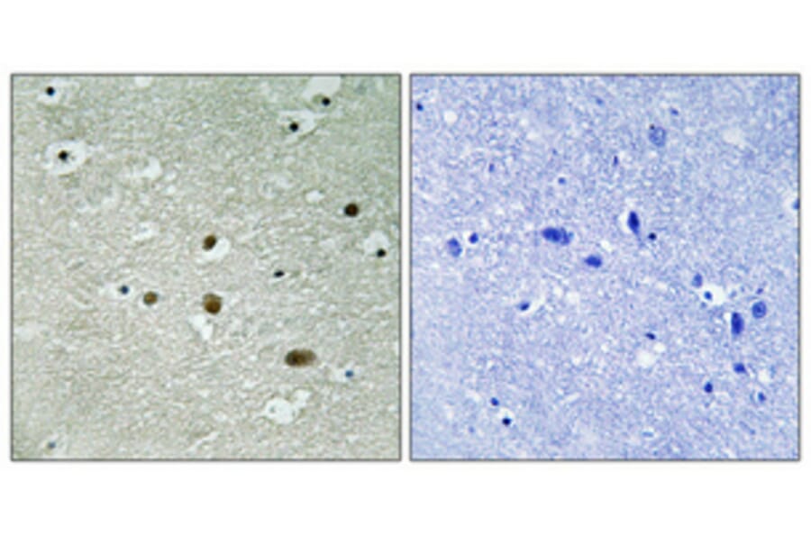 Immunohistochemistry - Anti-NPM (phospho Thr234) Antibody (A1166) - Antibodies.com