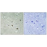 Immunohistochemistry - Anti-NPM (phospho Thr234) Antibody (A1166) - Antibodies.com