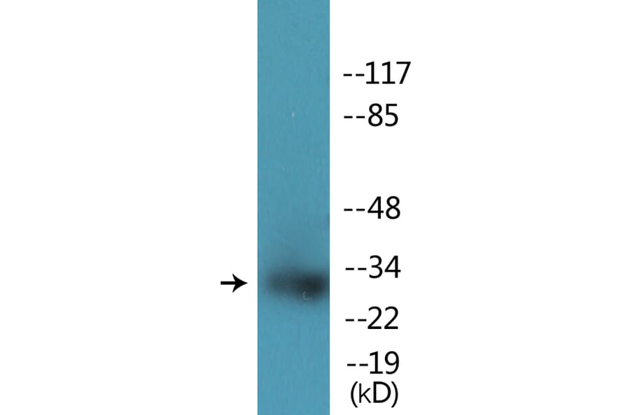 Western Blot - Anti-NPM (phospho Thr234) Antibody (P12-1156) - Antibodies.com