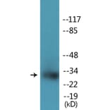 Western Blot - Anti-NPM (phospho Thr234) Antibody (P12-1156) - Antibodies.com