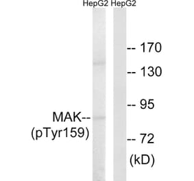 Western Blot - Anti-MAK (phospho Tyr159) Antibody (A8128) - Antibodies.com