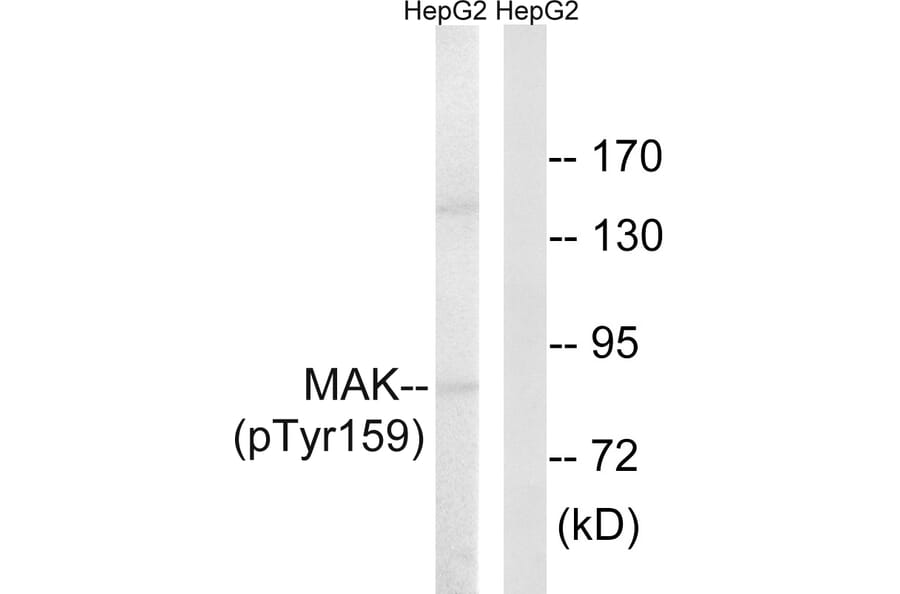 Western Blot - Anti-MAK (phospho Tyr159) Antibody (A8128) - Antibodies.com