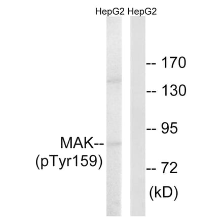 Western Blot - Anti-MAK (phospho Tyr159) Antibody (A8128) - Antibodies.com