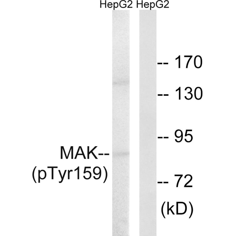 Western Blot - Anti-MAK (phospho Tyr159) Antibody (A8128) - Antibodies.com