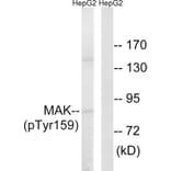 Western Blot - Anti-MAK (phospho Tyr159) Antibody (A8128) - Antibodies.com