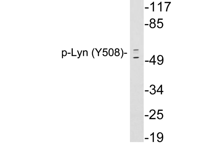 Western Blot - Anti-Lyn (phospho Tyr508) Antibody (P12-1035) - Antibodies.com