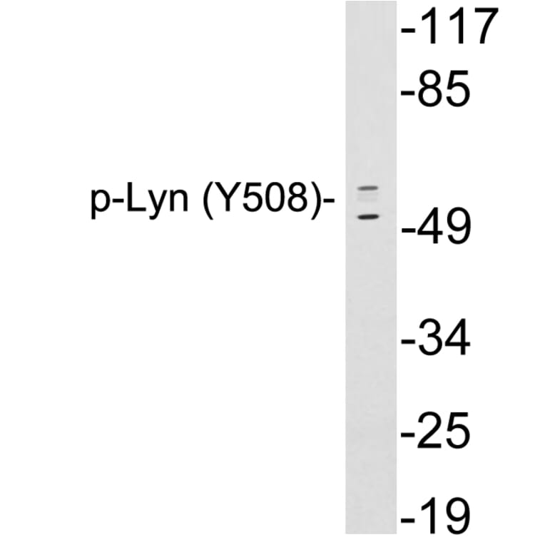 Western Blot - Anti-Lyn (phospho Tyr508) Antibody (P12-1035) - Antibodies.com