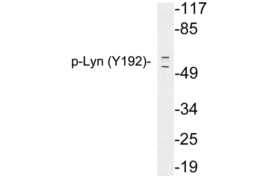 Western Blot - Anti-Lyn (phospho Tyr192) Antibody (P12-1034) - Antibodies.com