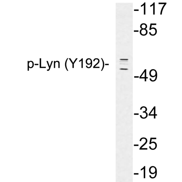 Western Blot - Anti-Lyn (phospho Tyr192) Antibody (P12-1034) - Antibodies.com