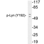 Western Blot - Anti-Lyn (phospho Tyr192) Antibody (P12-1034) - Antibodies.com