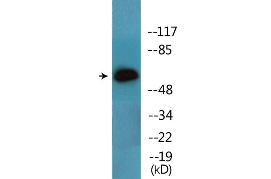 Western Blot - Anti-Lck (phospho Tyr393) Antibody (P12-1136) - Antibodies.com