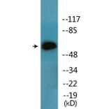 Western Blot - Anti-Lck (phospho Tyr393) Antibody (P12-1136) - Antibodies.com